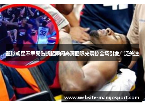 篮球明星不幸受伤断腿瞬间高清图曝光震惊全场引发广泛关注